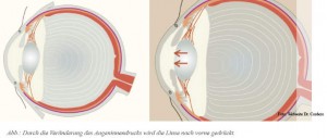 115 wp 06 Cordero Auge GrünSta